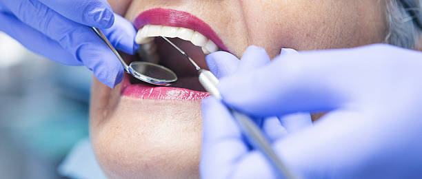 Best Same-Day Emergency Dental Services in Inverness, CA