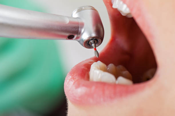 Best Emergency Gum Treatment in Inverness, CA